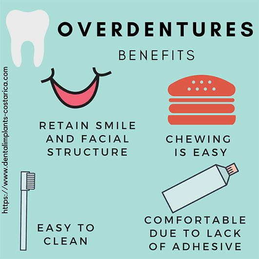 tips-for-overdentures-in-costa-rica