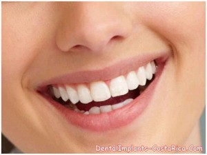 Client after Dental Implant in Costa Rica