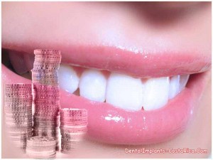 Cost of Smile Design in Costa Rica