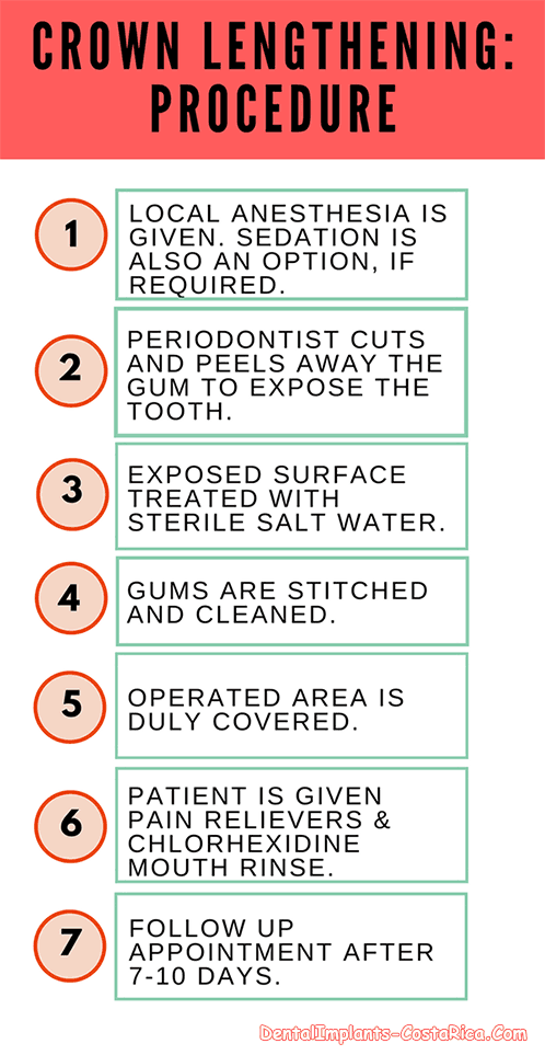 crown-lengthening-procedure
