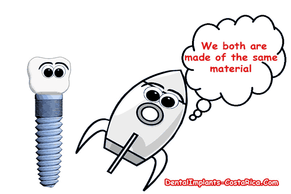 5 Things You Didn’t Know About Dental Implants