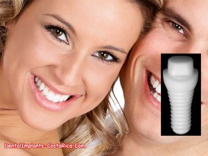 CeraRoot Implants