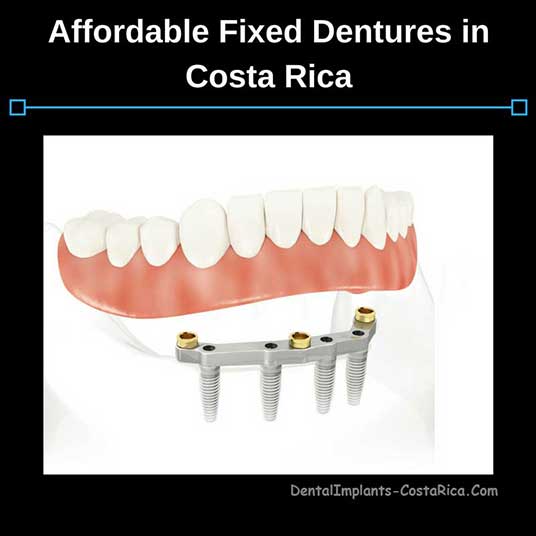 affordable-fixed-dentures-in-costa-rica
