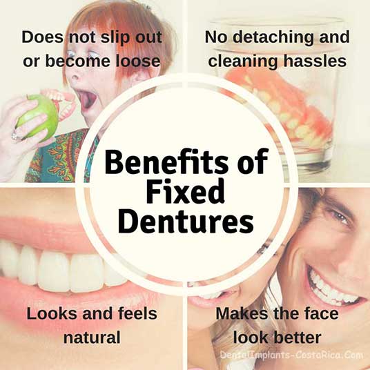 benefits-of-fixed-dentures